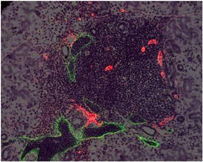 High Endothelial Venules and Lymphatic Vessels in Tertiary Lymphoid Organs: Characteristics, Functions, and Regulation